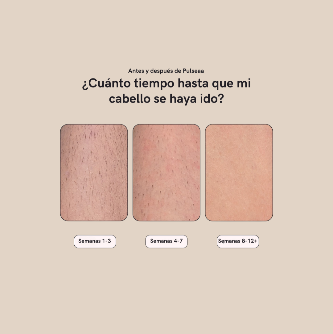 IPL PULSEAA 5000 - Aparato de depilación permanente